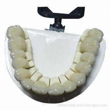 Zirconia Bridge, Ideal Solution for Posteriors Instead of PFM Metal Occlusals or Full Metal Crowns